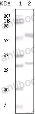 Western blot for Anti-ESR1/ER-alpha Antibody (R2Y35) ?>