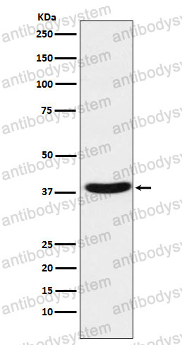 Anti-MT-ND1 Antibody (R1J30)