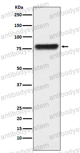 Anti-KLKB1 Antibody (R1J31)