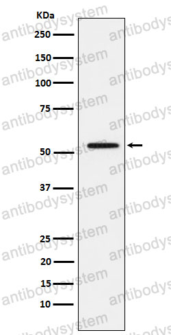 Anti-MMP1 Antibody (R1J32)