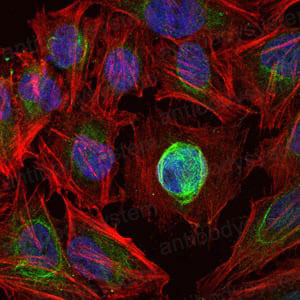 Immunofluorescence for Anti-MMP1 Antibody (R3A68) ?>