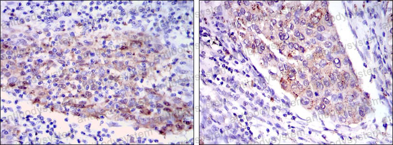 Immunohistochemical for Anti-MMP1 Antibody (R3A68) ?>