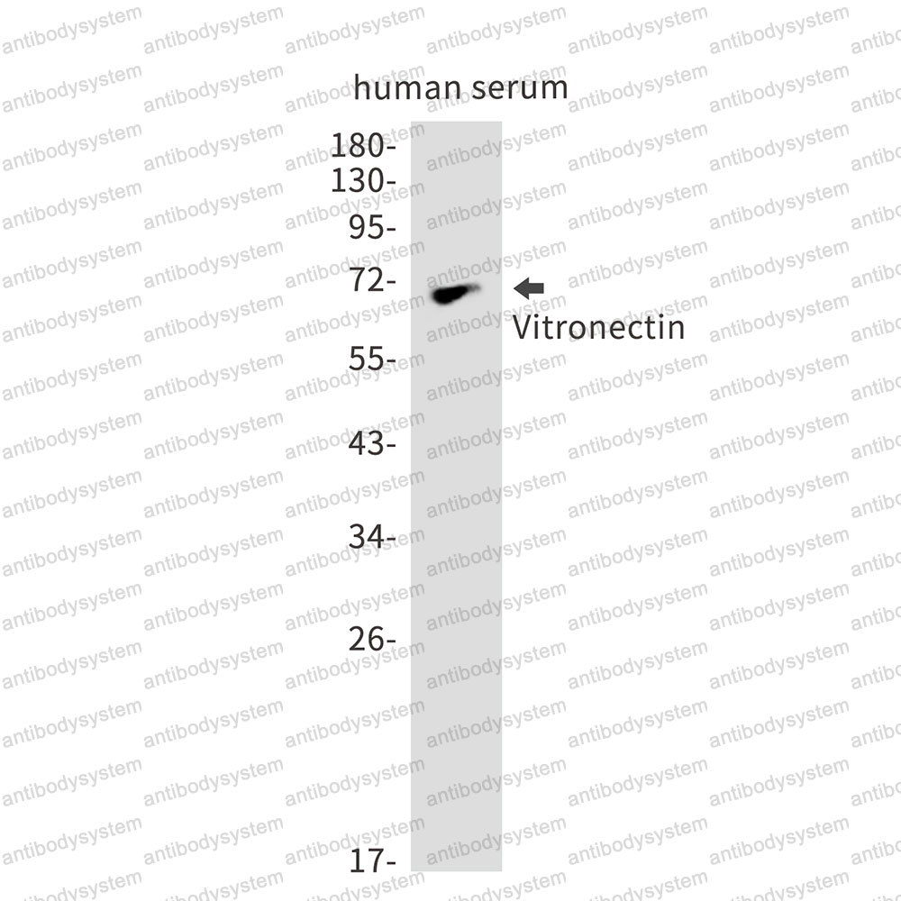 Anti-VTN/Vitronectin Antibody (R1J33)