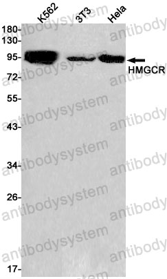 Anti-HMGCR Antibody (R1J35)