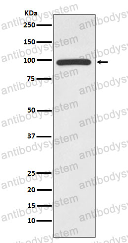 Anti-HMGCR Antibody (R1J34)