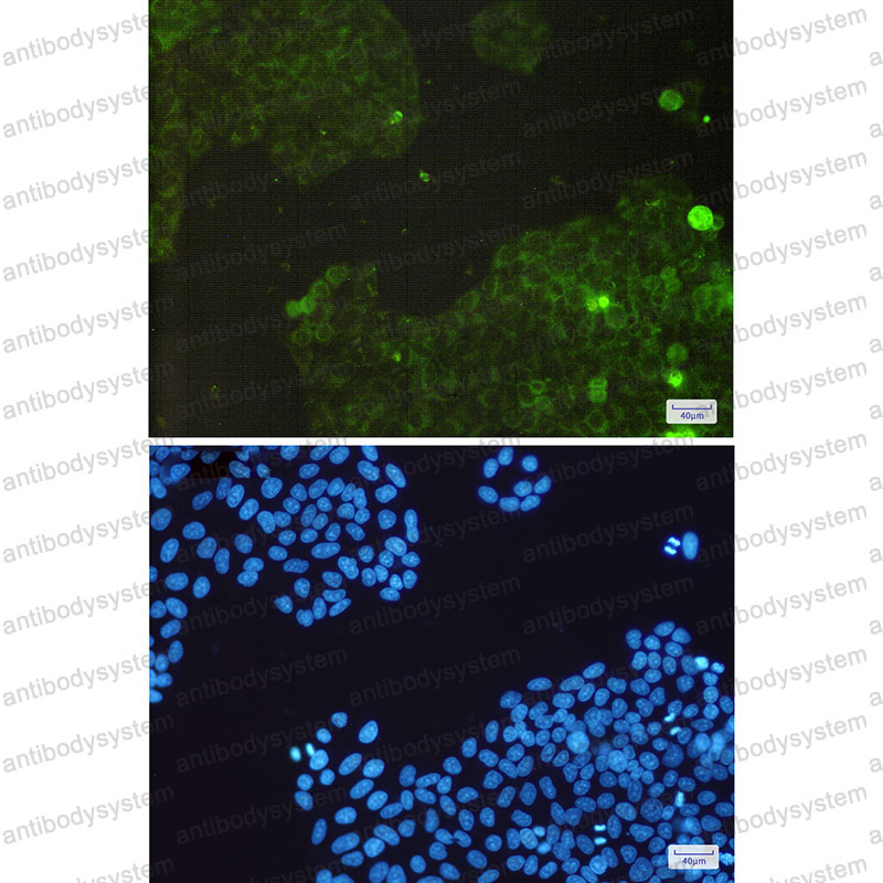 Anti-CAT/Catalase Antibody (R1J39)