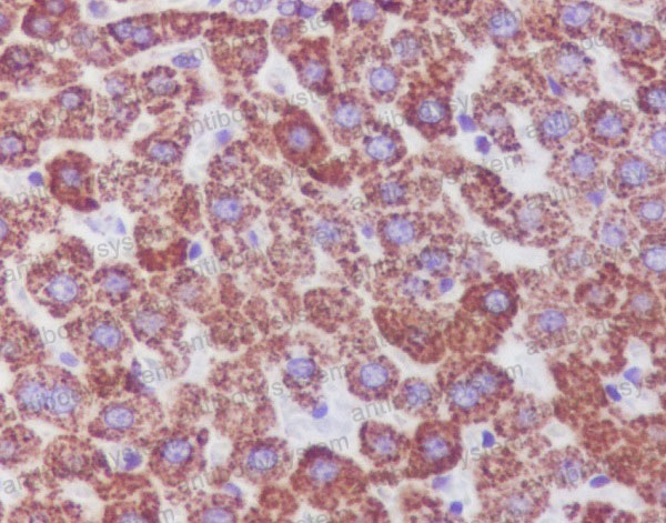 Anti-CAT/Catalase Antibody (R1J36)