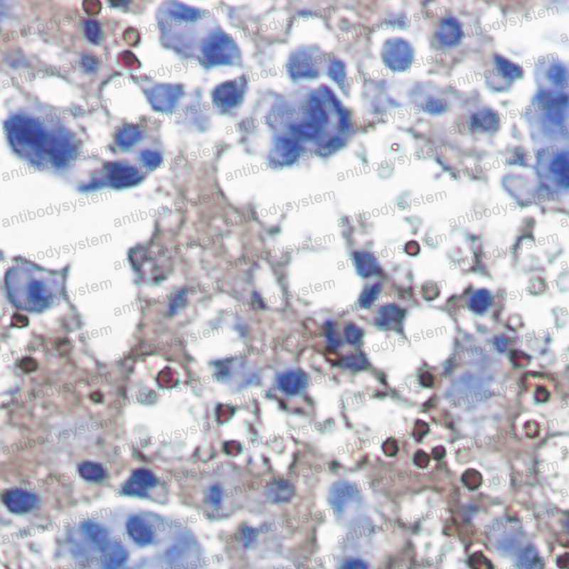 Anti-CAT/Catalase Antibody (R1J38)