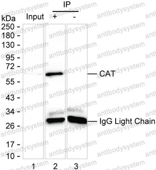 Immunoprecipitation for Anti-CAT/Catalase Antibody (R2Y46) ?>
