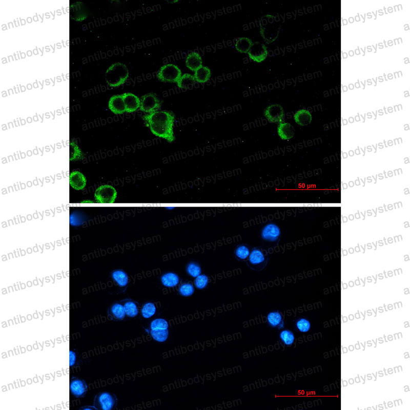 Anti-RAF1 Antibody (R1J41)