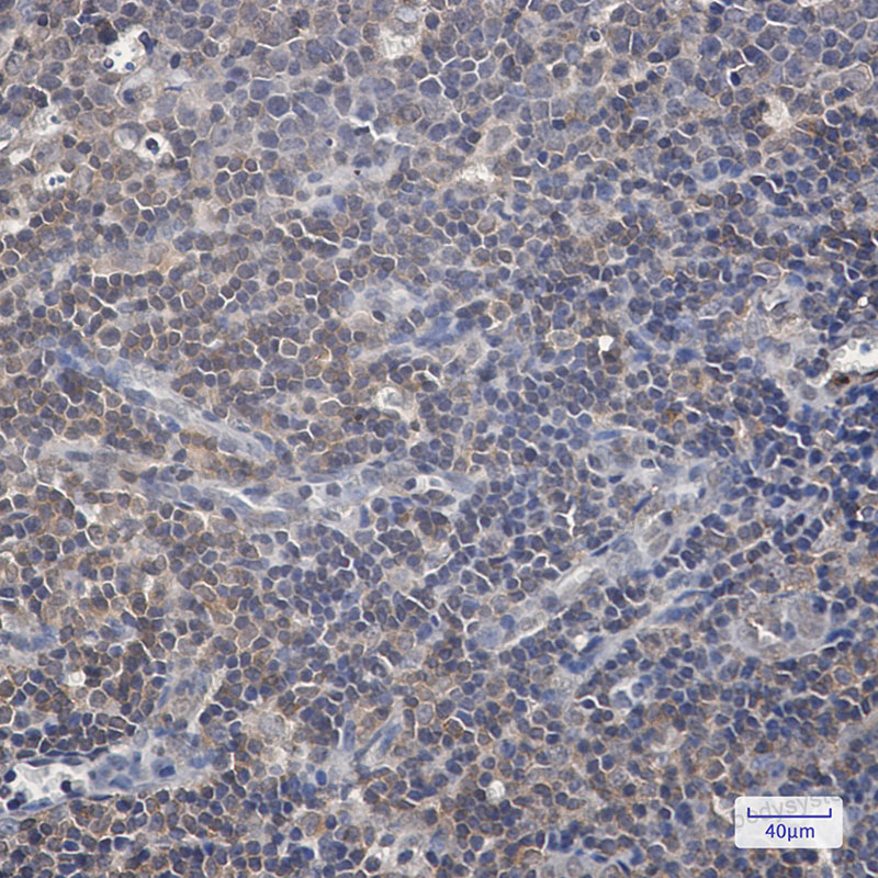 Anti-Phospho-RAF1 (Ser259) Antibody (R1J40)