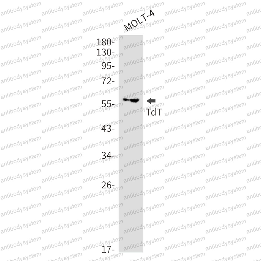 Anti-DNTT Antibody (R1J42)
