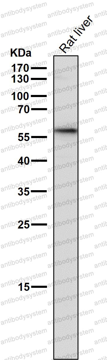 Anti-GBA Antibody (R1J43)