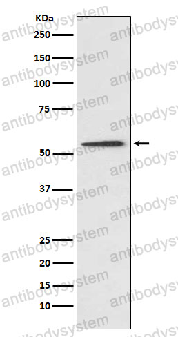 Anti-PROC Antibody (R1J44)