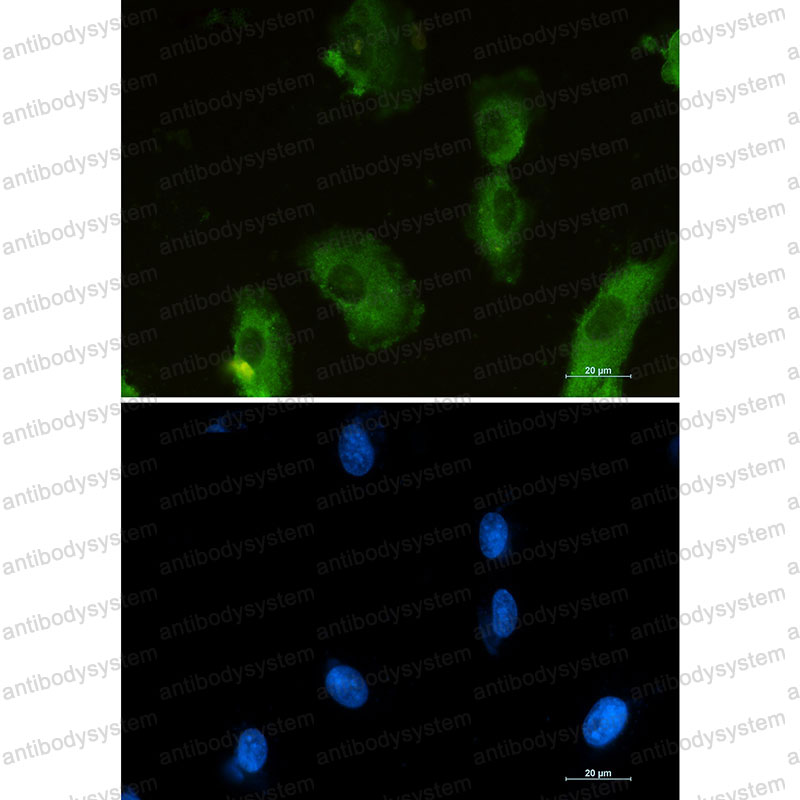 Anti-ALDOA Antibody (R1J45)