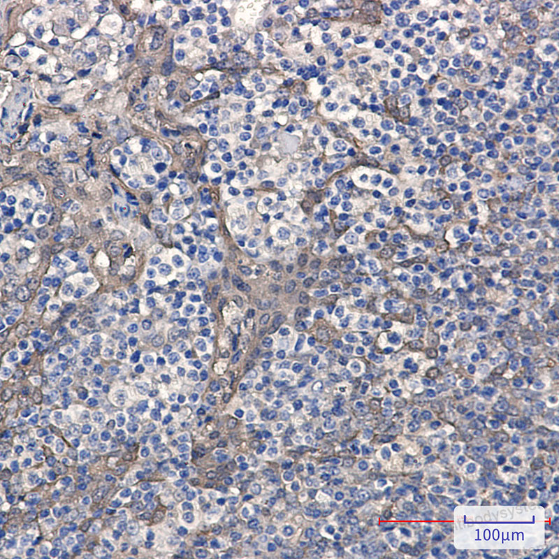 Anti-CSTB Antibody (R1J47)