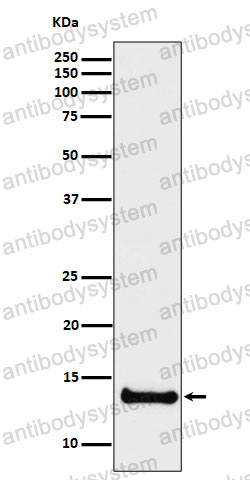 Anti-CSTB Antibody (R1J46)