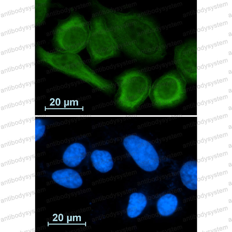 Anti-ANXA1/Annexin A1 Antibody (R1J48)