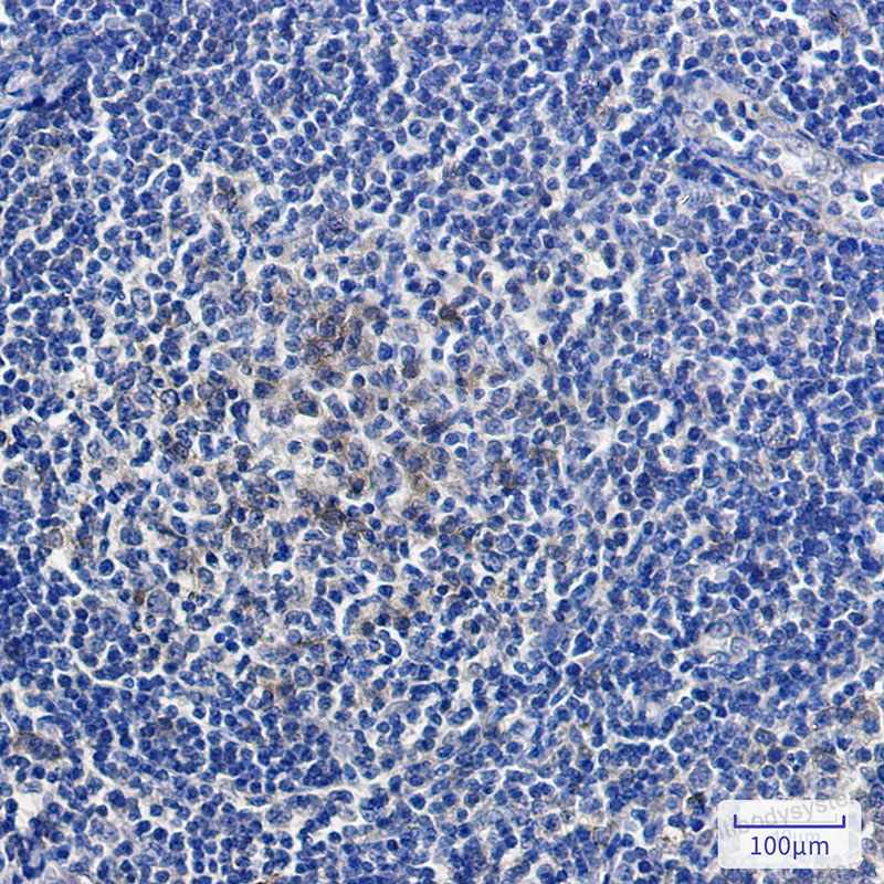Anti-RLN2 Antibody (R1J49)