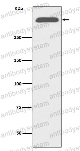 Anti-APOB Antibody (R1J50)