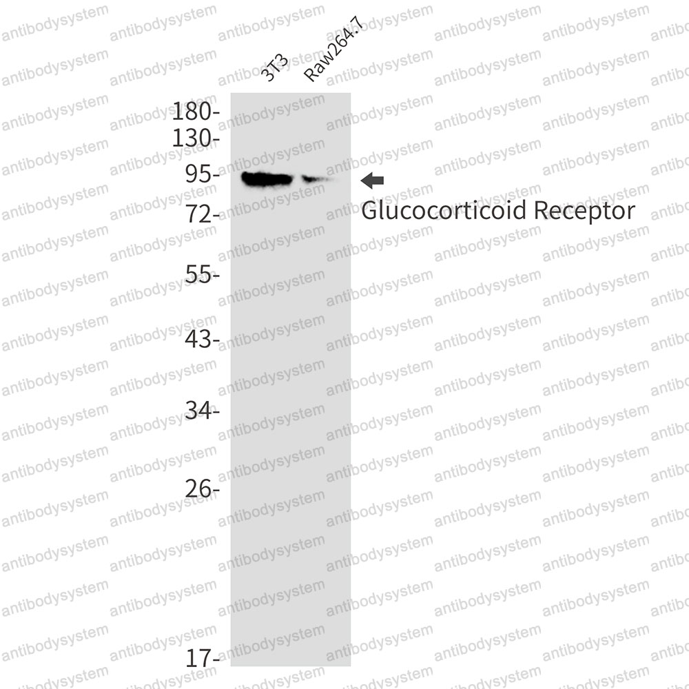 Anti-NR3C1 Antibody (R1J53)