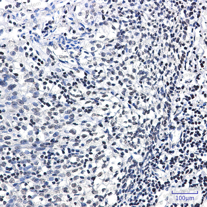 Anti-Phospho-NR3C1 (Ser226) Antibody (R1J51)