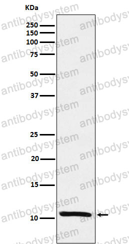 Anti-TFF1 Antibody (R1J54)
