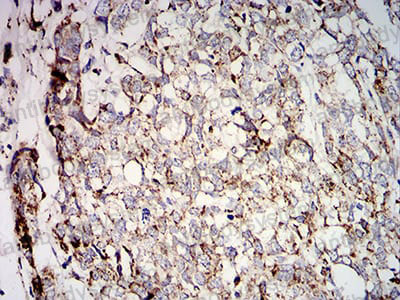 Immunohistochemical for Anti-SOD2 Antibody (R2Y61) ?>