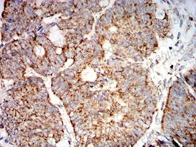 Immunohistochemical for Anti-SOD2 Antibody (R2Y61) ?>