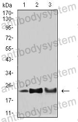 Western blot for Anti-SOD2 Antibody (R2Y61) ?>