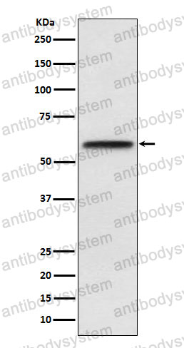 Anti-LCAT Antibody (R1J56)