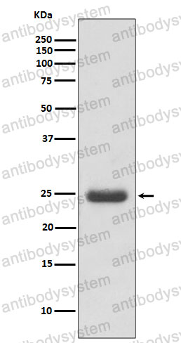 Anti-TK1 Antibody (R1J57)