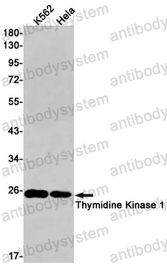 Anti-TK1 Antibody (R1J58)