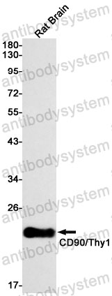 Anti-CD90/THY1 Antibody (R1J59)