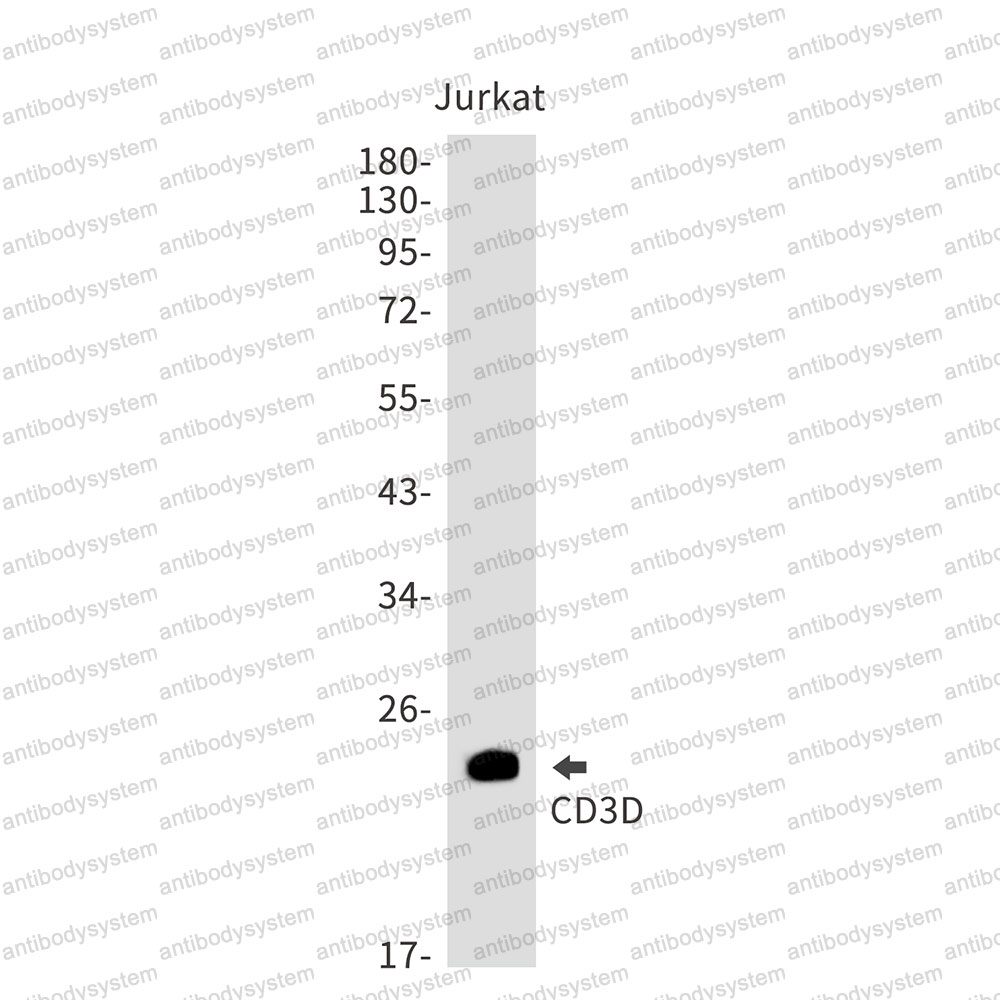 Anti-CD3D Antibody (R1J60)