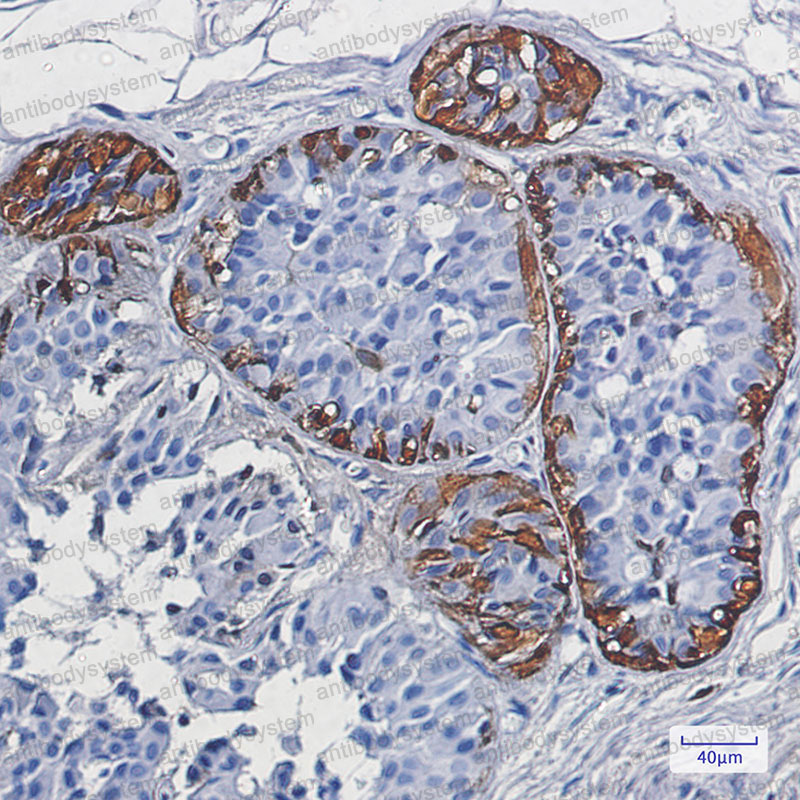 Anti-S100B Antibody (R1J61)