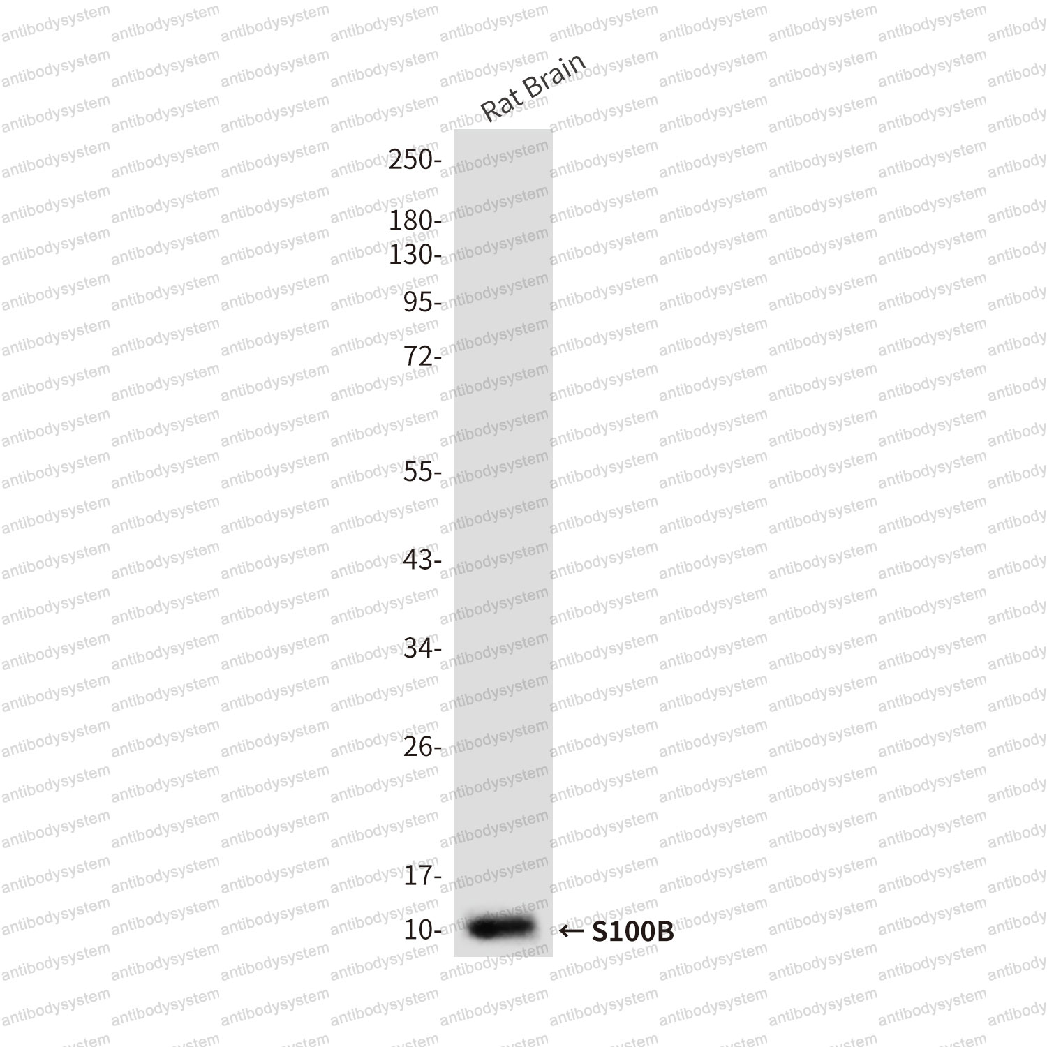 Anti-S100B Antibody (R2Y75)