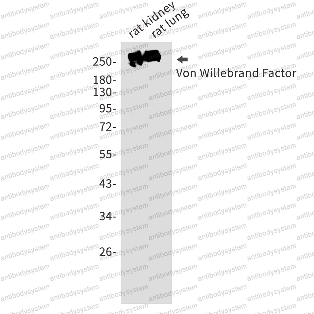 Anti-VWF Antibody (R1J63)