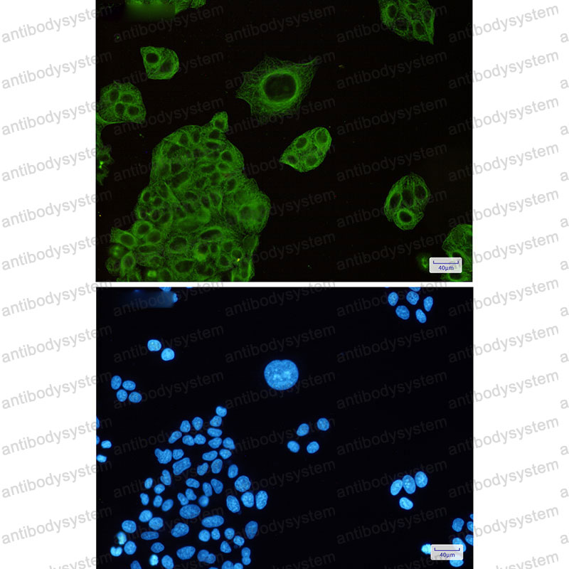 Anti-TUBB4A Antibody (R1J64)