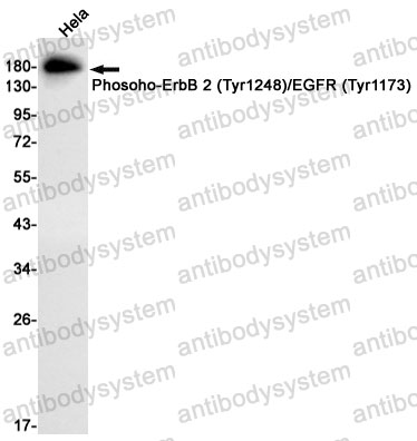 Anti-Phosoho-CD340/ERBB2/HER2 (Tyr1248/Tyr1173) Antibody (R1J65)