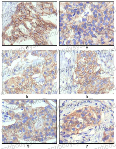 Anti-CD340/ERBB2/HER2/NEU Antibody (R2Y77)