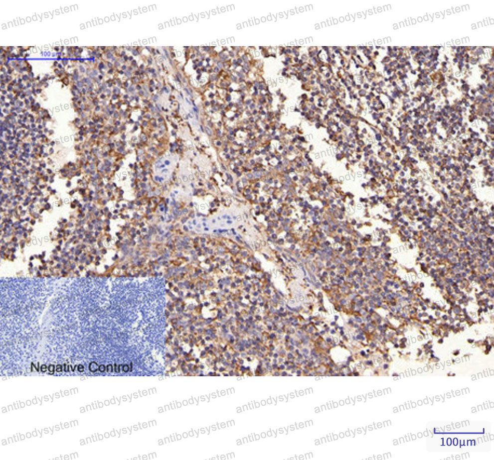 Anti-CD340/ERBB2/HER2/NEU Antibody (R2Y79)