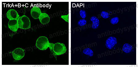 Anti-TrkA/B/C Antibody (R1J66)