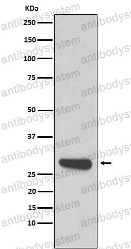Anti-CAPNS1 Antibody (R1J68)