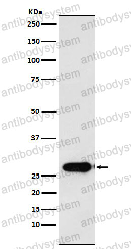 Anti-CAPNS1 Antibody (R1J67)