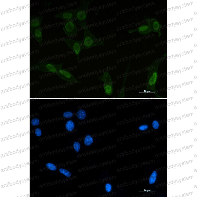 Anti-Acetyl-p53 (Lys370) Antibody (R1J69)