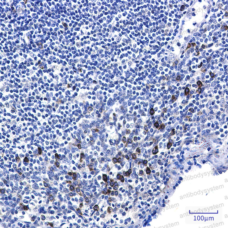 Anti-Phospho-TP53/p53 (Ser6) Antibody (R1J70)