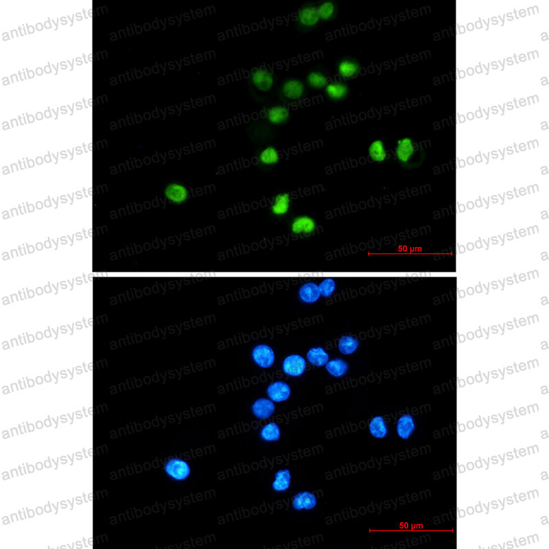 Anti-TP53/p53 Antibody (R1J71)