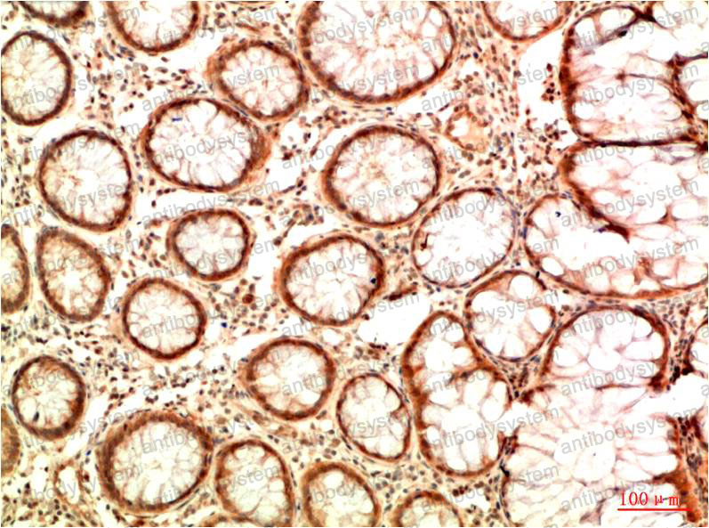 Immunohistochemical for Anti-TP53/p53 Antibody (R2Y82) ?>