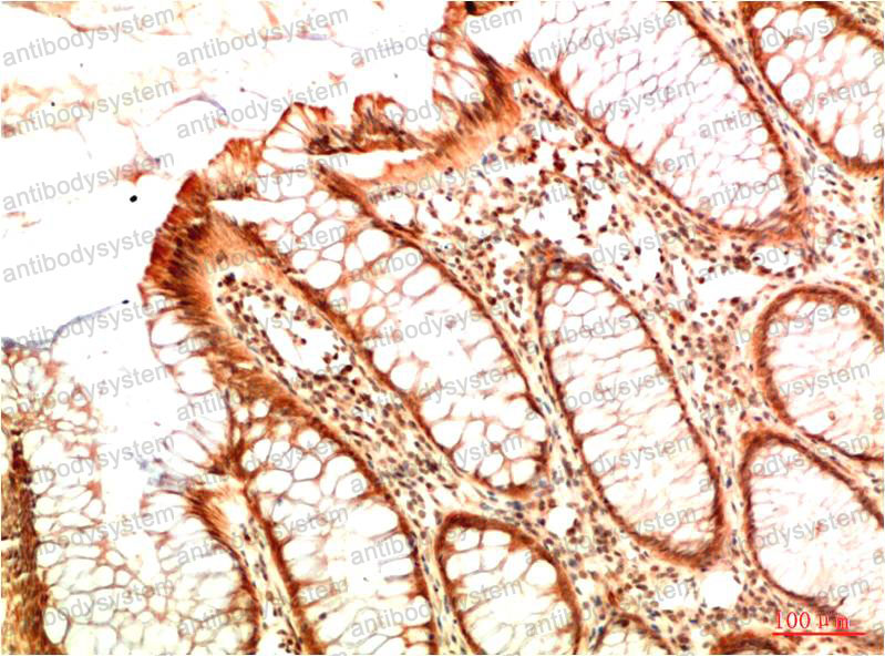 Immunohistochemical for Anti-TP53/p53 Antibody (R2Y82) ?>